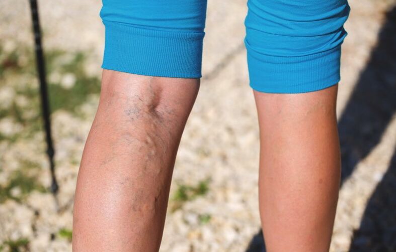 Daño a la parte inferior de la pierna